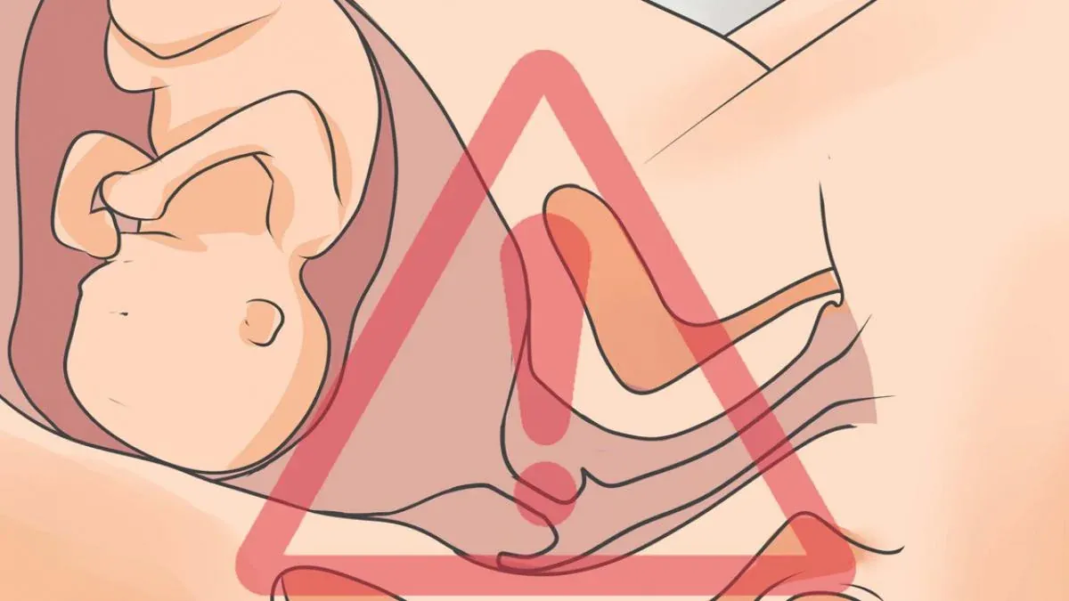 Bộ 39 hình ảnh rỉ ối giúp mẹ bầu nhận biết chuẩn xác · ảnh 2